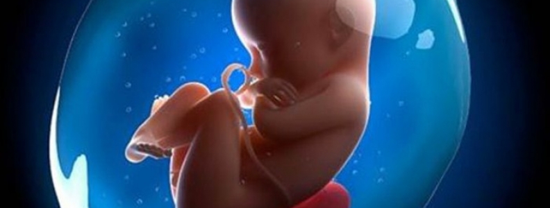 การตรวจวินิจฉัยก่อนคลอดโดยการเจาะน้ำคร่ำ (Amniocentesis)