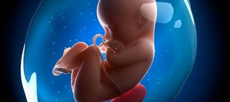 การตรวจวินิจฉัยก่อนคลอดโดยการเจาะน้ำคร่ำ (Amniocentesis)